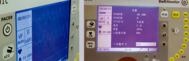 德國 普美康 XD系列 除顫監護儀 德國 普美康 XD系列 除顫監護儀